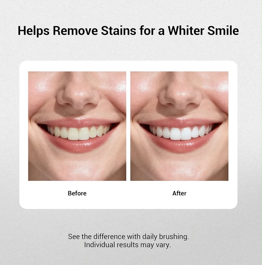 ✨ Rivexo™ 7-Pro Whitening Toothpaste